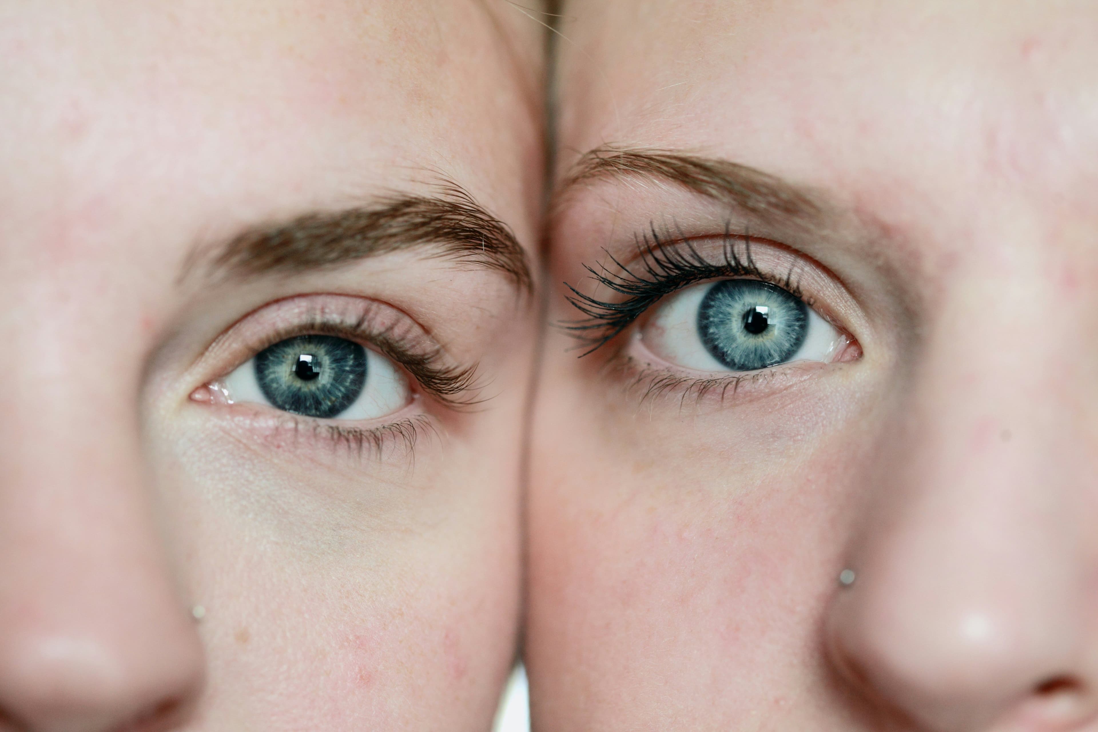 (Lasik vs Smile)