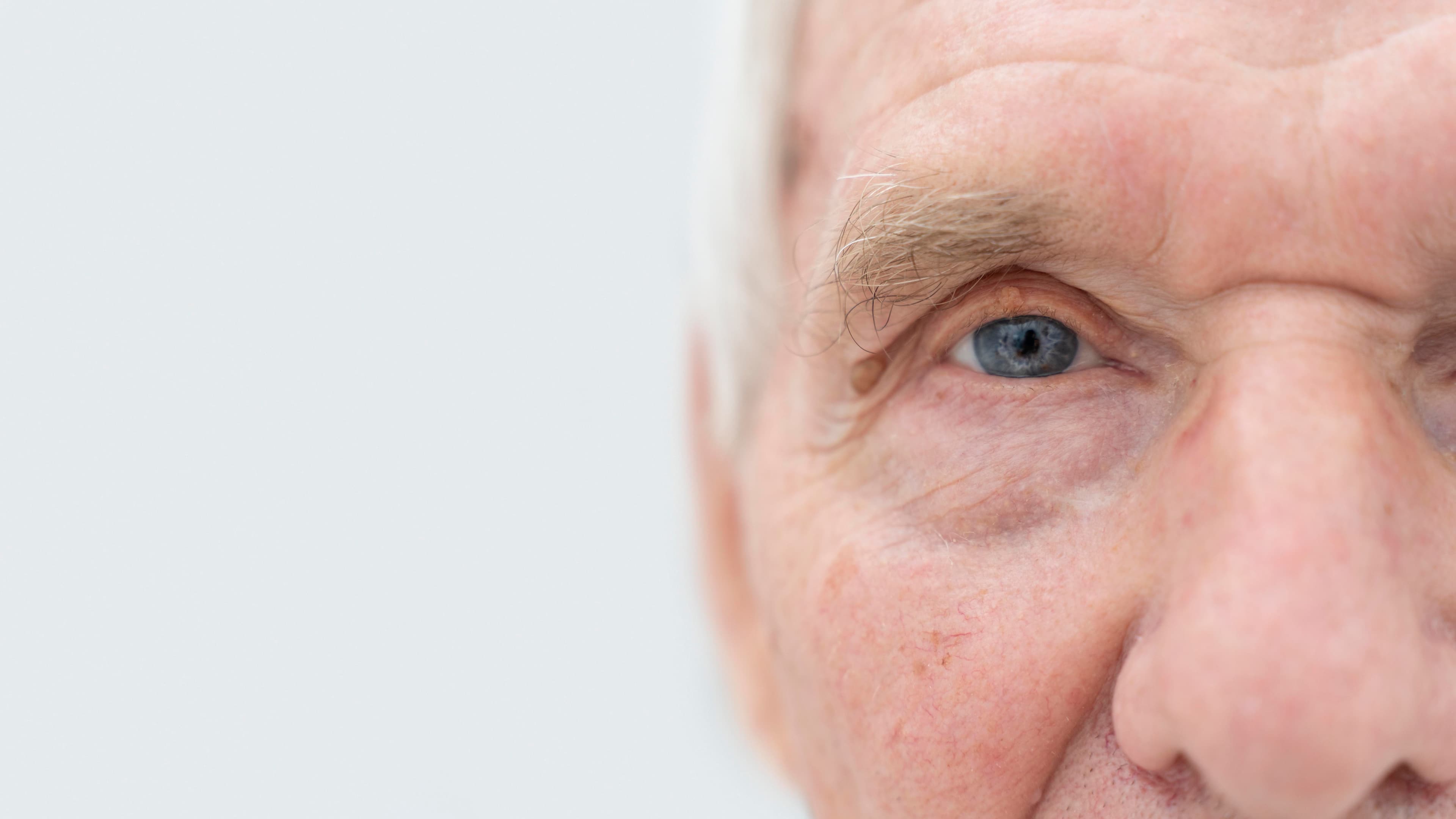 understanding age-related macular degeneration